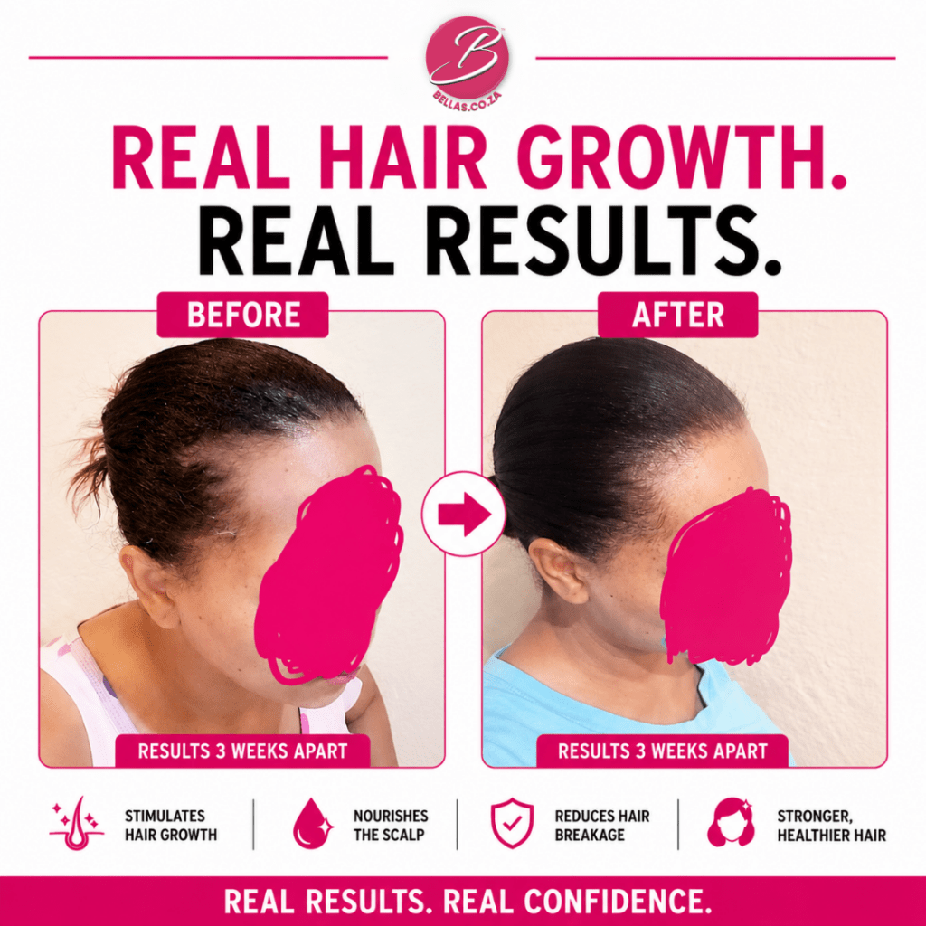 Before and after hair growth results showing visible regrowth and thicker hair after three weeks using Holly's Hair Growth Range.